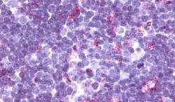 CCR9 Polyclonal Antibody, Invitrogen 50 &mu;g; Unconjugated:Antibodies,