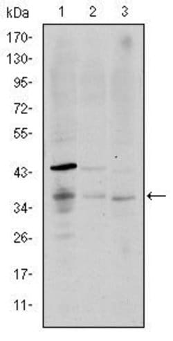 Invitrogen CD1a Monoclonal Antibody (6H3) 100 &mu;L | Buy Online | Invitrogen&trade; | Fisher Scientific