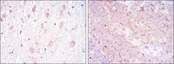 Invitrogen CD1a Monoclonal Antibody (7A7) 100 &mu;L | Buy Online | Invitrogen&trade; | Fisher Scientific