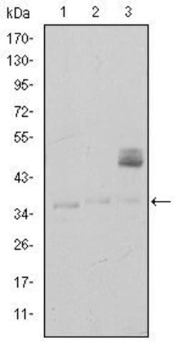 Invitrogen CD1a Monoclonal Antibody (7A7) 100 &mu;L | Buy Online | Invitrogen&trade; | Fisher Scientific