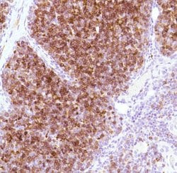 Invitrogen&trade;&nbsp;CD1a Monoclonal Antibody (SP157)