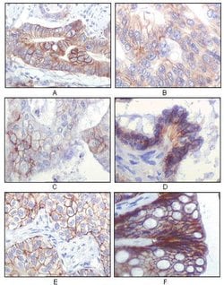 Invitrogen IGF1R beta Monoclonal Antibody (3C8B1) 100 &mu;L; Unconjugated:Antibodies,