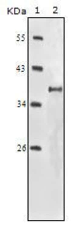 Invitrogen IGF1R beta Monoclonal Antibody (3C8B1) 100 &mu;L; Unconjugated:Antibodies,