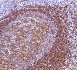 Invitrogen CD22 Polyclonal Antibody 500 &mu;L; Unconjugated:Antibodies,