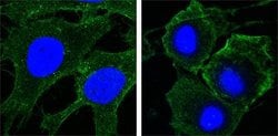Invitrogen VEGF Receptor 2 Monoclonal Antibody (4B4) 100 &mu;L; Unconjugated:Antibodies,