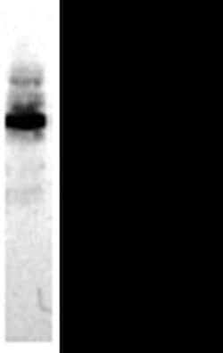 Invitrogen E-cadherin Monoclonal Antibody (MB2) 100 &mu;L; Unconjugated:Antibodies,