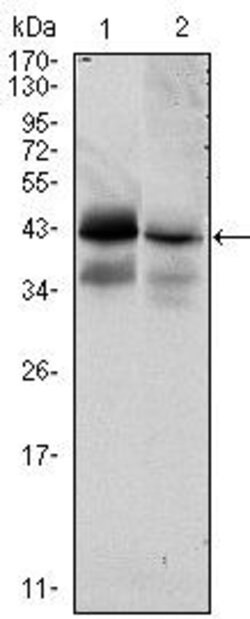 Invitrogen EpCAM Monoclonal Antibody (7E11) 100 &mu;L; Unconjugated:Antibodies,