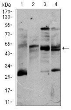 Invitrogen CD5 Monoclonal Antibody (6A11) 100 &mu;g | Buy Online | Invitrogen&trade; | Fisher Scientific