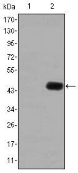 Invitrogen CEA Monoclonal Antibody (1C7) 100 &mu;L | Buy Online | Invitrogen&trade; | Fisher Scientific