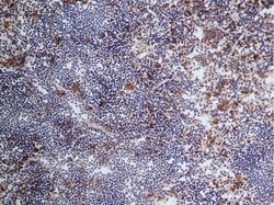 Invitrogen CD68 Monoclonal Antibody (FA-11) 250 &mu;g; Unconjugated:Antibodies,