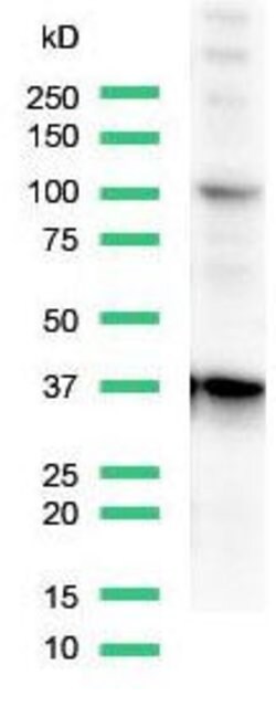Invitrogen CD68 Polyclonal Antibody 100 &mu;L | Buy Online | Invitrogen&trade; | Fisher Scientific