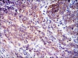 Invitrogen CD9 Monoclonal Antibody (5G6) 100 &mu;L; Unconjugated:Antibodies,