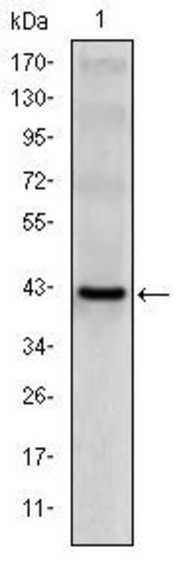 Invitrogen CD94 Monoclonal Antibody (3G2) 100 &mu;L | Buy Online | Invitrogen&trade; | Fisher Scientific