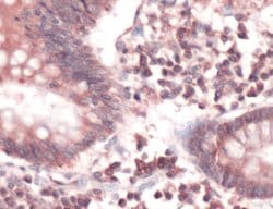 Invitrogen FAS Polyclonal Antibody:Antibodies:Primary Antibodies