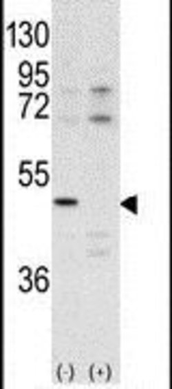 CDK10 Rabbit anti-Human, Polyclonal, Invitrogen 400 &mu;L; Unconjugated:Antibodies,