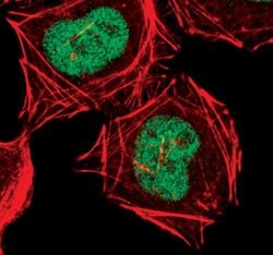 Invitrogen CDK9 Monoclonal Antibody (K.513.1) 100 &mu;L; Unconjugated:Antibodies,