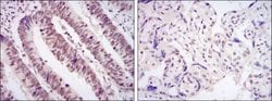 Invitrogen CDK9 Monoclonal Antibody (1B5A7) 100 &mu;L; Unconjugated:Antibodies,