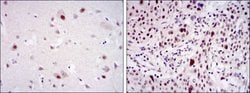 Invitrogen CDK9 Monoclonal Antibody (1B5A7) 100 &mu;L; Unconjugated:Antibodies,