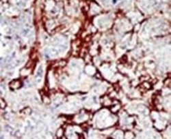 CDKL1 Rabbit anti-Human, Mouse, Polyclonal, Invitrogen 400 &mu;L; Unconjugated:Antibodies,
