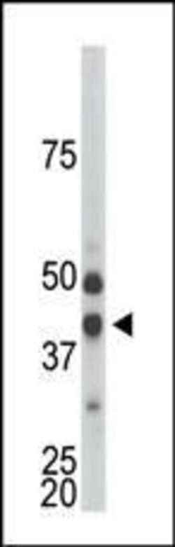 CDKL1 Rabbit anti-Human, Mouse, Polyclonal, Invitrogen 400 &mu;L; Unconjugated:Antibodies,