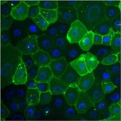 CEA, clone: 1105, Invitrogen 100&mu;g; Unconjugated:Antibodies, Monoclonal