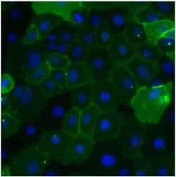 Invitrogen CEA Monoclonal Antibody (1106) 1 mg; Unconjugated:Antibodies,