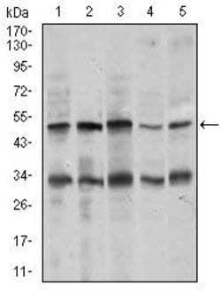 Invitrogen Chromogranin A Monoclonal Antibody (1A6B6) 100 &mu;g; Unconjugated:Antibodies,