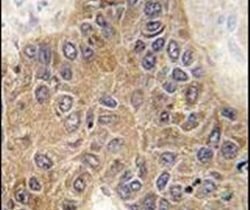 STUB1 Rabbit anti-Human, Polyclonal, Invitrogen 400 &mu;L; Unconjugated:Antibodies,