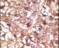 STUB1 Rabbit anti-Human, Polyclonal, Invitrogen 400 &mu;L; Unconjugated:Antibodies,