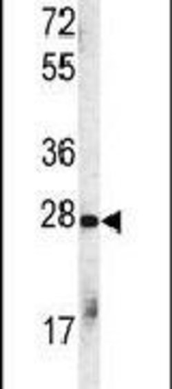 STUB1 Rabbit anti-Human, Polyclonal, Invitrogen 400 &mu;L; Unconjugated:Antibodies,