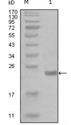 Invitrogen IKK alpha Monoclonal Antibody (7C10B6, 1A10A10) 100 &mu;L; Unconjugated:Antibodies,