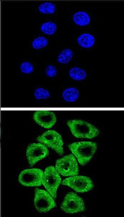 CITED2 Rabbit anti-Human, Mouse, Polyclonal, Invitrogen 400 &mu;L; Unconjugated:Antibodies,