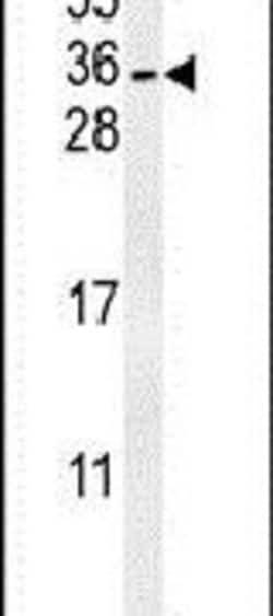 CITED2 Rabbit anti-Human, Mouse, Polyclonal, Invitrogen 400 &mu;L; Unconjugated:Antibodies,