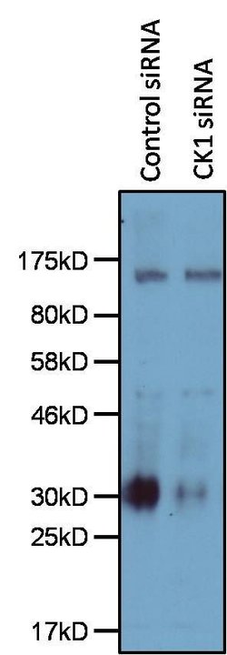 Invitrogen CK1 alpha Polyclonal Antibody 100 μL; Unconjugated:Antibodies,