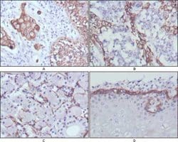 Invitrogen Cytokeratin 17 Monoclonal Antibody (3B12) 100 &mu;L; Unconjugated:Antibodies,