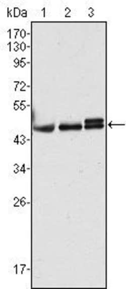 Invitrogen Cytokeratin 17 Monoclonal Antibody (3B12) 100 &mu;L; Unconjugated:Antibodies,