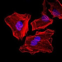 Invitrogen Cytokeratin 5 Monoclonal Antibody (2C2) 100 &mu;g; Unconjugated:Antibodies,