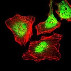 Invitrogen Cytokeratin 5 Monoclonal Antibody (2C2) 100 &mu;g; Unconjugated:Antibodies,