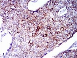 Invitrogen Cytokeratin 5 Monoclonal Antibody (2C2) 100 &mu;g; Unconjugated:Antibodies,