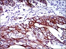 Invitrogen Cytokeratin 5 Monoclonal Antibody (2C2) 100 &mu;g; Unconjugated:Antibodies,
