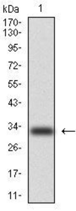 Invitrogen Cytokeratin 5 Monoclonal Antibody (2C2) 100 &mu;g; Unconjugated:Antibodies,