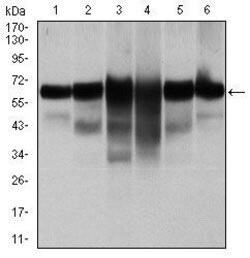 Invitrogen Cytokeratin 5 Monoclonal Antibody (2C2) 100 &mu;g; Unconjugated:Antibodies,