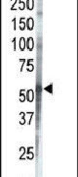 CK1 gamma-3 Rabbit anti-Human, Polyclonal, Invitrogen 400 &mu;L; Unconjugated:Antibodies,