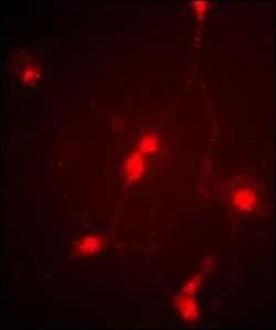 CLCN4 Rabbit anti-Chicken, Human, Polyclonal, Invitrogen 400 &mu;L; Unconjugated:Antibodies,