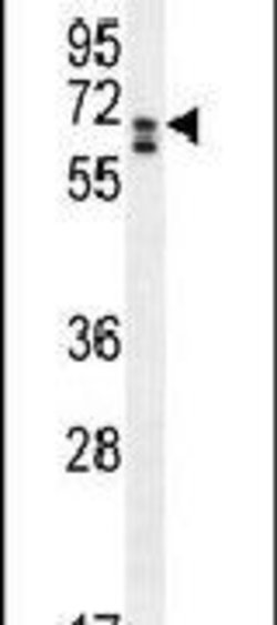 CLIP3 Rabbit anti-Human, Polyclonal, Invitrogen 400 &mu;L; Unconjugated:Antibodies,