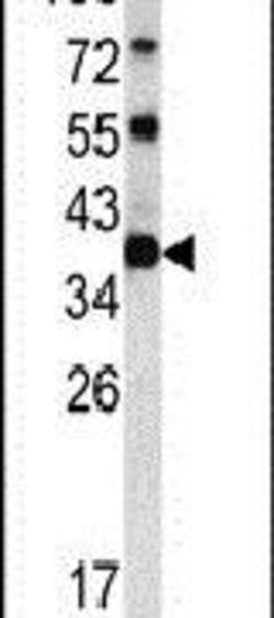 CLNS1A Rabbit anti-Human, Polyclonal, Invitrogen 400 &mu;L; Unconjugated:Antibodies,