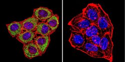 Invitrogen CNGA3 Monoclonal Antibody (CNC 9C1) 100 &mu;L; Unconjugated:Antibodies,