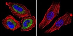 Invitrogen CNGA3 Monoclonal Antibody (CNC 9C1) 100 &mu;L; Unconjugated:Antibodies,