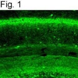 Cannabinoid Receptor 1 Polyclonal Antibody, Invitrogen 100 &mu;L; Unconjugated:Antibodies,