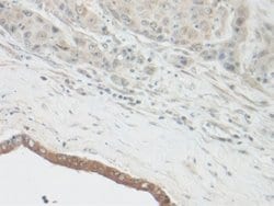 Invitrogen CNTF Polyclonal Antibody 100 &mu;g; Unconjugated:Antibodies,